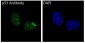 Anti-p53 TP53 Rabbit Monoclonal Antibody